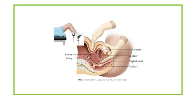 Endometrial Carcinoma