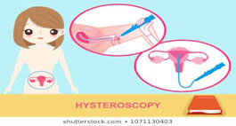 Endometrial Carcinoma